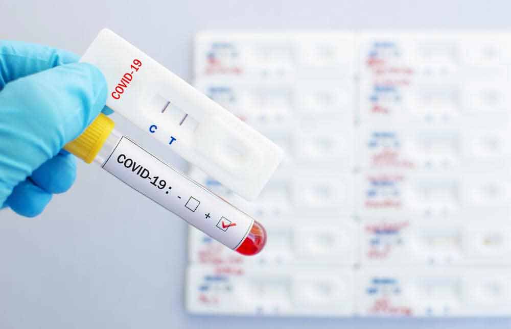 ¿Qué seguro de salud cubre el coste de las PCR?