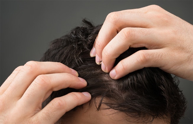 Cómo frenar la caída del cabello