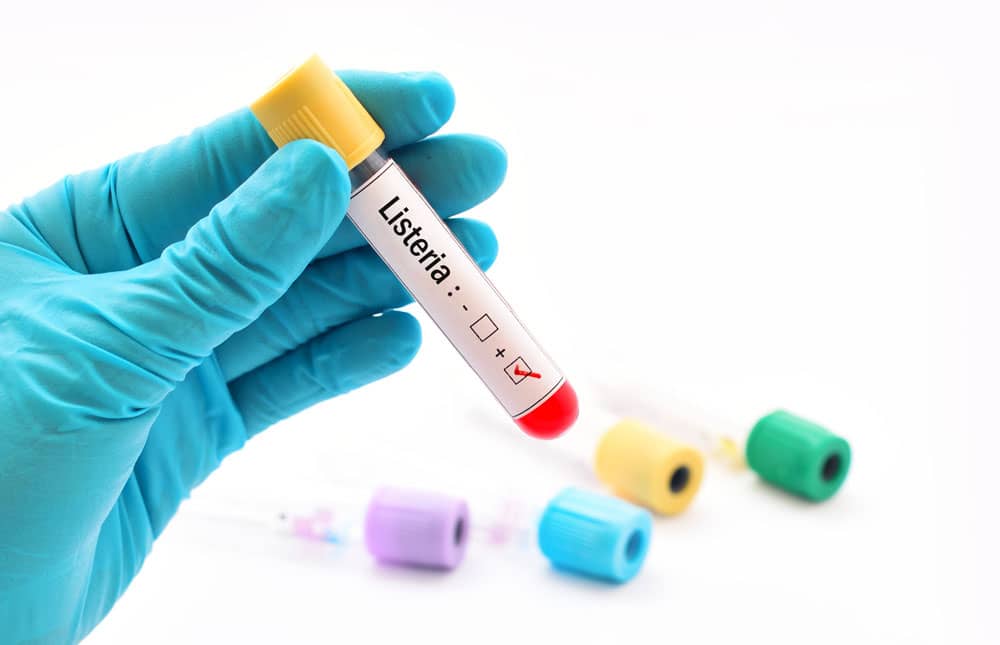 ¿Qué es la listeriosis?